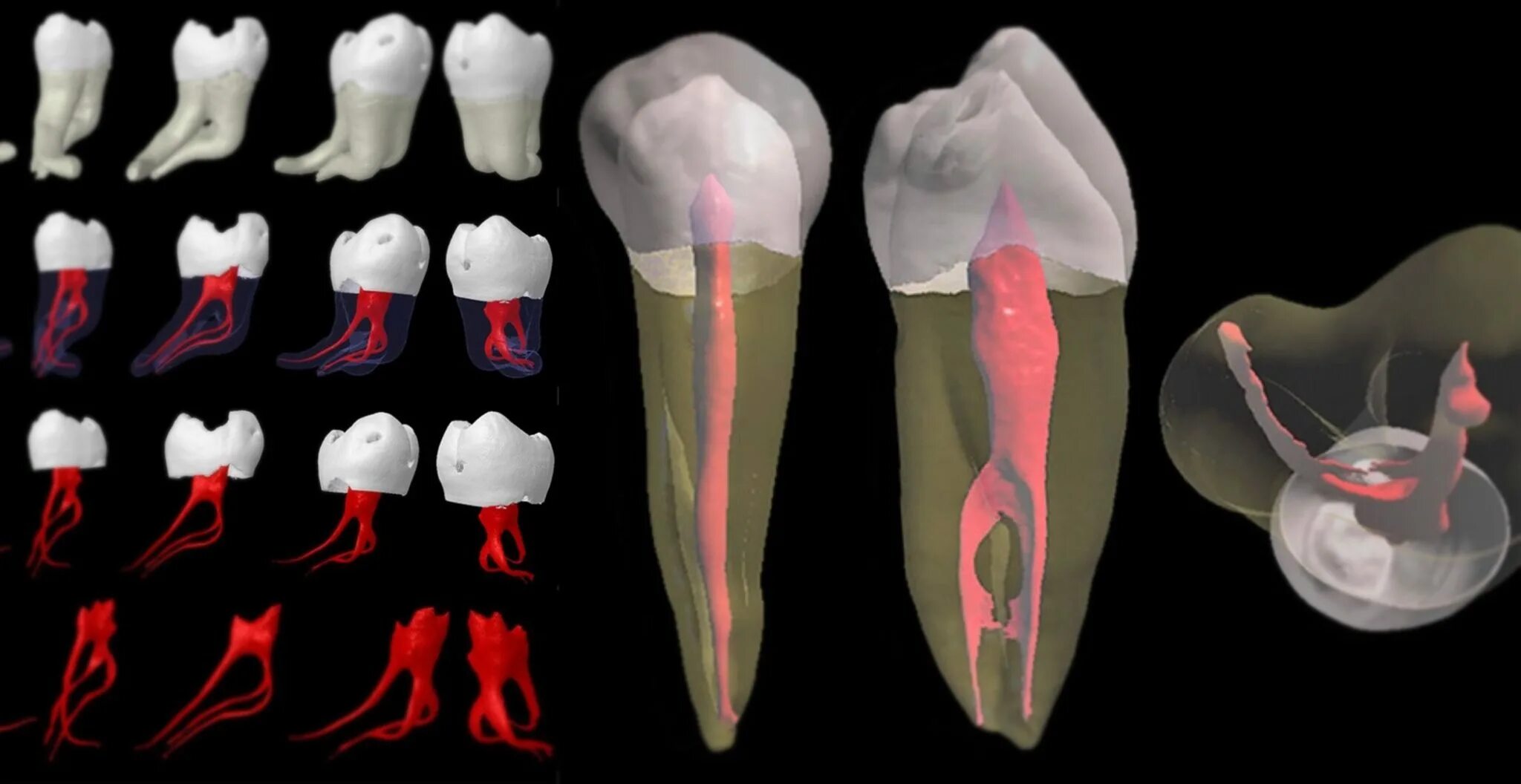 Каналы 46 зуба анатомия корневые. Анатомия корневых каналов зубов верхней и нижней челюсти. Нервы корни зубов анатомия. Анатомия корневых каналов 3д. Формы корневых каналов