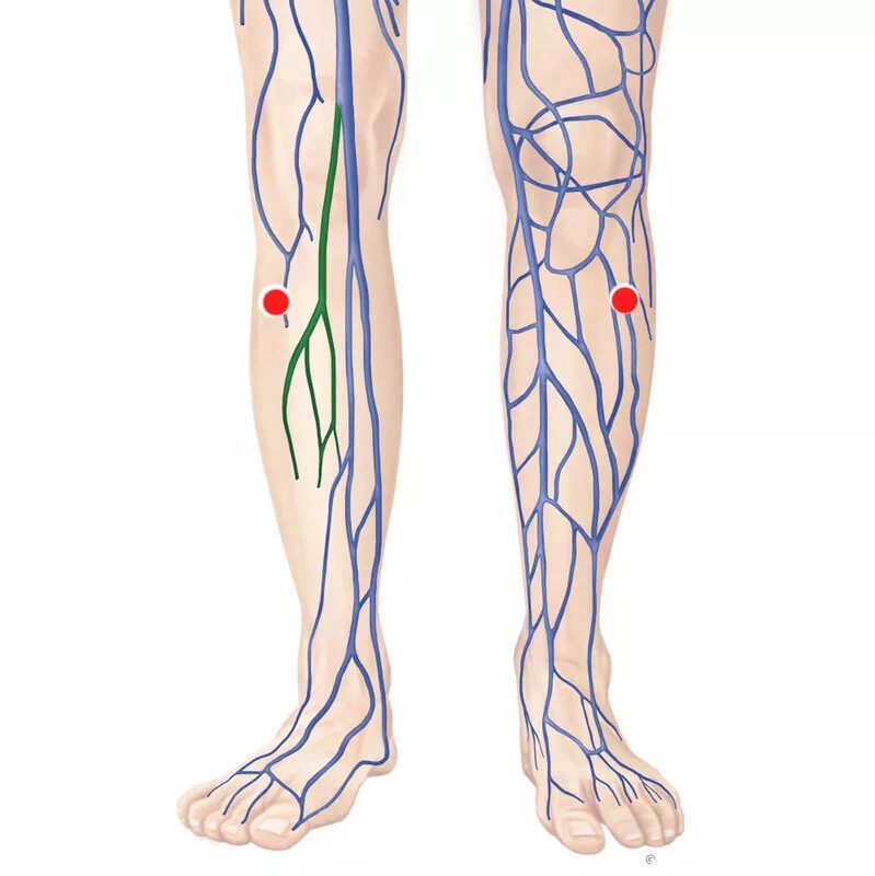 Японский лимфодренажный. Лимфатическая система на ногах нижних конечностей. Лимфатическая система человека ногах отеки.