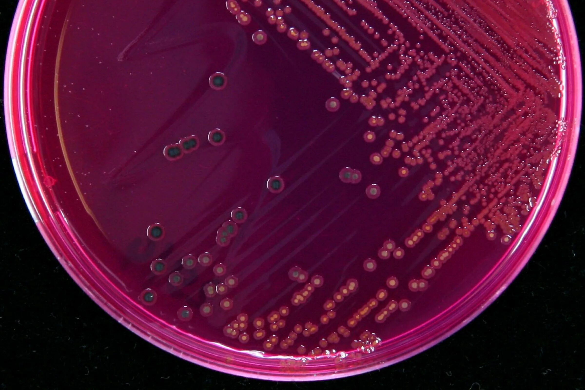 Колонии эшерихий сальмонелл шигелл. Сальмонелла агар Эндо. Bordetella pertussis чашка Петри. Сальмонеллы на среде Эндо. Среда для кишечной палочки