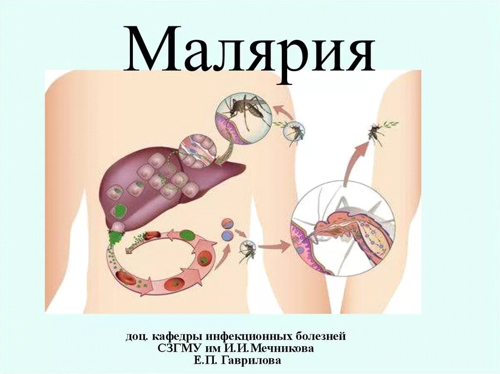 Первичная малярия это. Малярийный плазмодий симптомы. Инфекционные заболевания малярия.