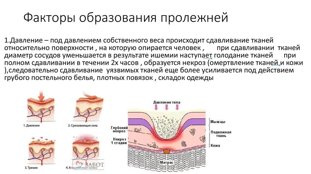 Почему образуются внутренние. Основные патогенетические механизмы развития пролежней. Факторы образования пролежней схема. Факторы риска развития пролежней схема. Факторы влияющие на появление пролежней.