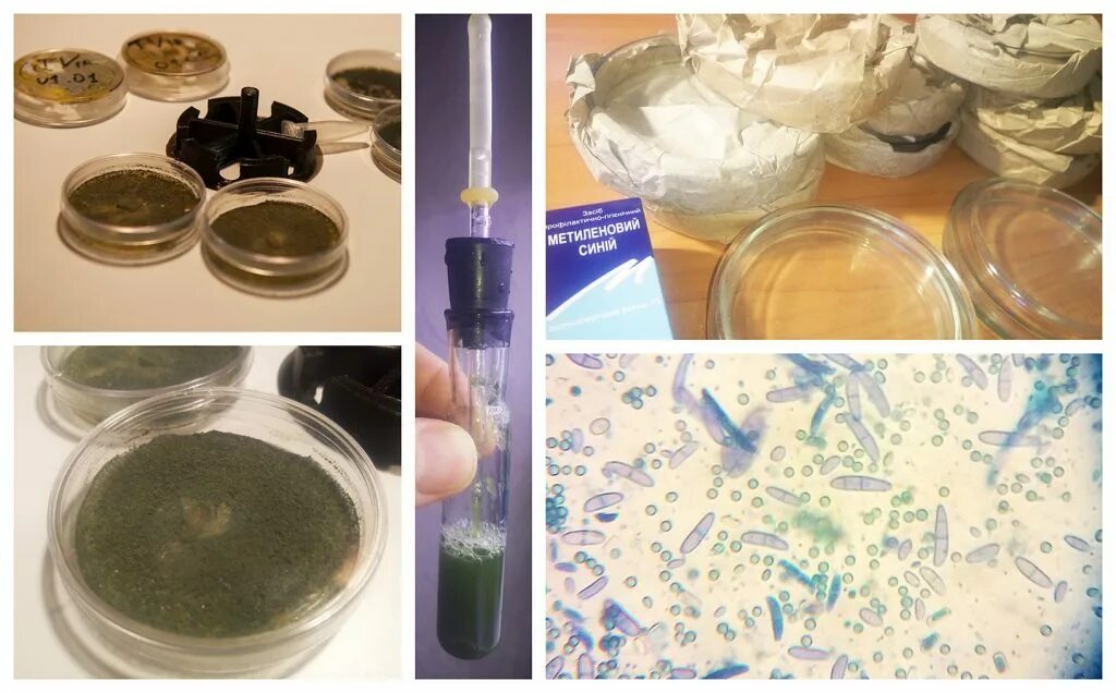 чашка петри с бактериями. чашки петри бактериология. чашки петри с мпа. чашка петри культуральная. синегнойная палочка в чашке петри.