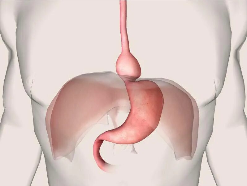 Грыжа пищевода строение. Грыжа пищеводного отдела диафрагмы. Грыжа пищевода как выглядит. Грыжа диафрагмального отверстия пищевода. Аксиальная хиатальная грыжа.