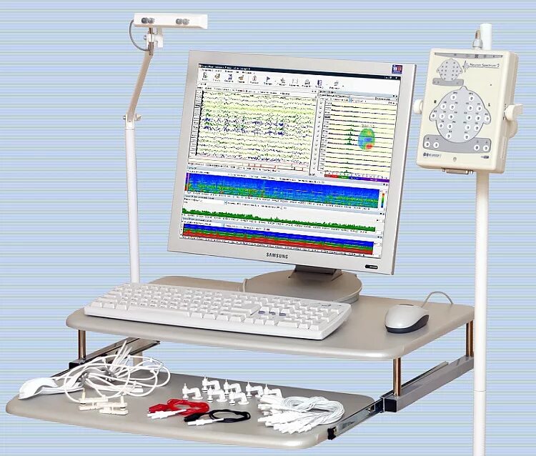 Эмг вп. Энмг верхних и нижних конечностей. Электромиография (emg). Энмг стимуляционная верхних конечностей. Электромиография принцип метода.
