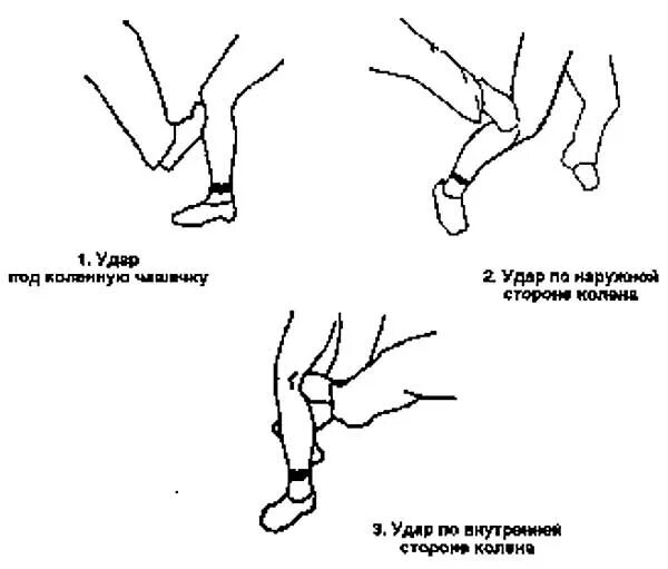 Удар ногой в коленную чашечку. Удар носком в коленную чашечку. Удар в коленную чашечку техника. Упреждающий удар это