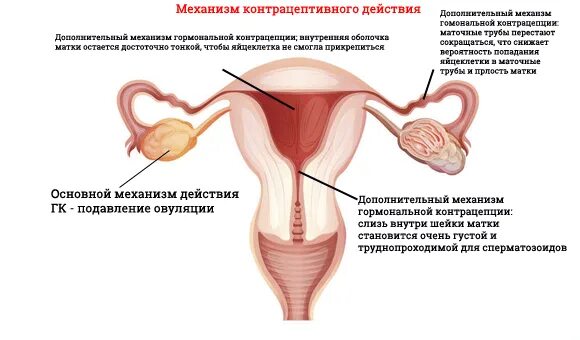 Куда девается яйцеклетка если нет трубы