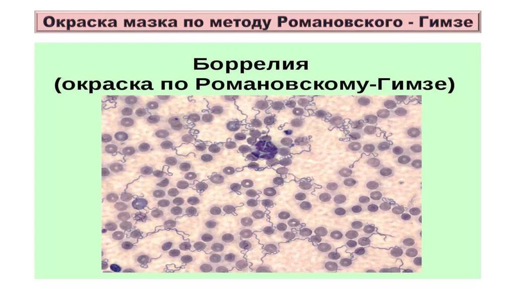 Окраска по методу романовского гимза. Романовскому гимзе окраска. Методика окраски по романовскому – гимза:. Окраска по методу романовского гимза. Окраска по методу романовского гимзы.