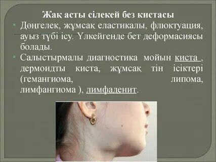 Орыс бисексуалы мойынқозы