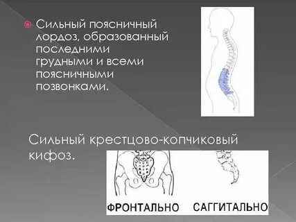 Физиологический поясничный