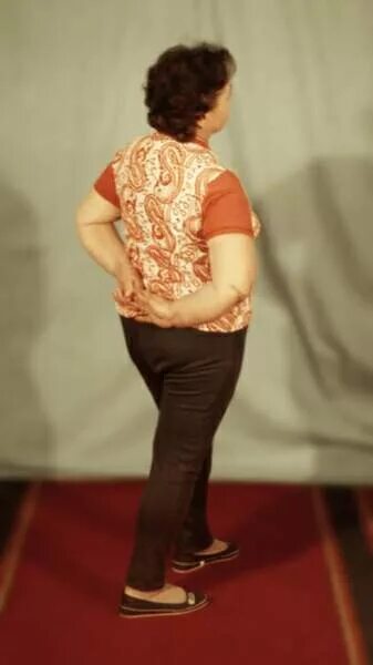 хирургической шейки плечевой кости. упражнения после перелома хирургической шейки плечевой кости. упражнения после перелома плечевого бугорка. упражнения после перелома плечевого бугорка. упражнения после перелома плечевого бугорка.