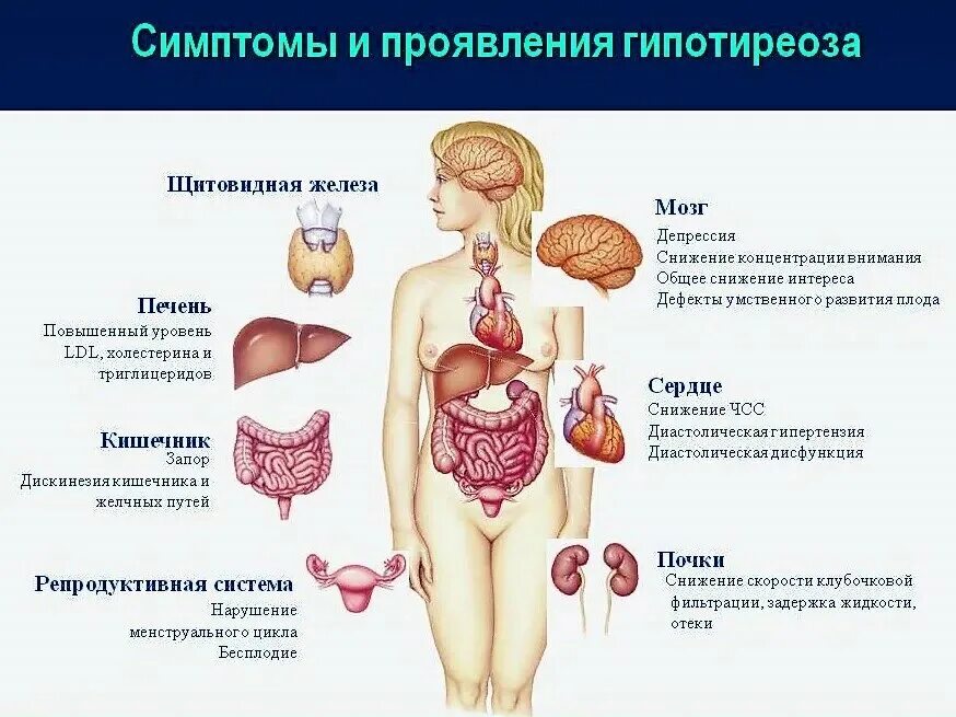 Гипотиреоз органы мишени. Симптомы сниженной функции щитовидной железы у женщин. Снижение функции щитовидной железы симптомы у женщин. Гипотиреоз недостаток гормонов симптомы.