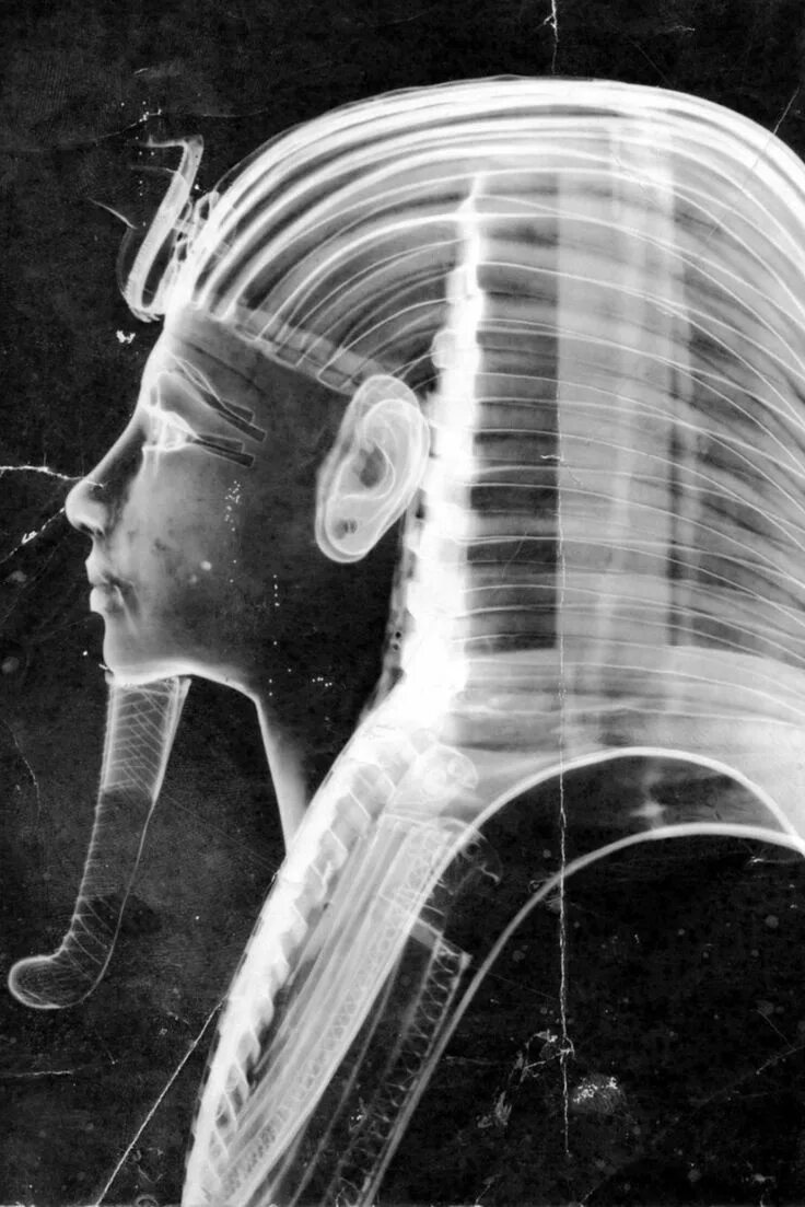 8 апр 2023. Нефертити в рентгеновских лучах. Мы под рентгеном. Рентген ученый.
