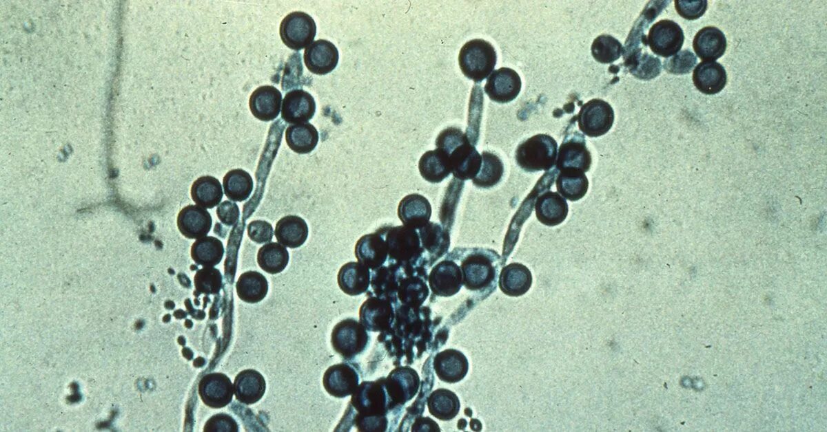 Candida albicans полукол