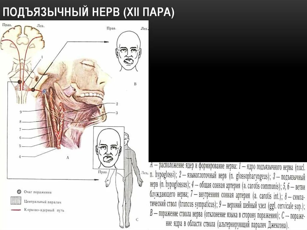 Подъязычный нерв функции. Xii пара - подъязычный нерв. xii пара - подъязычный нерв симптомы поражения. xii пара. подъязычный нерв (n. hypoglossus). подъязычный нерв первый нейрон.