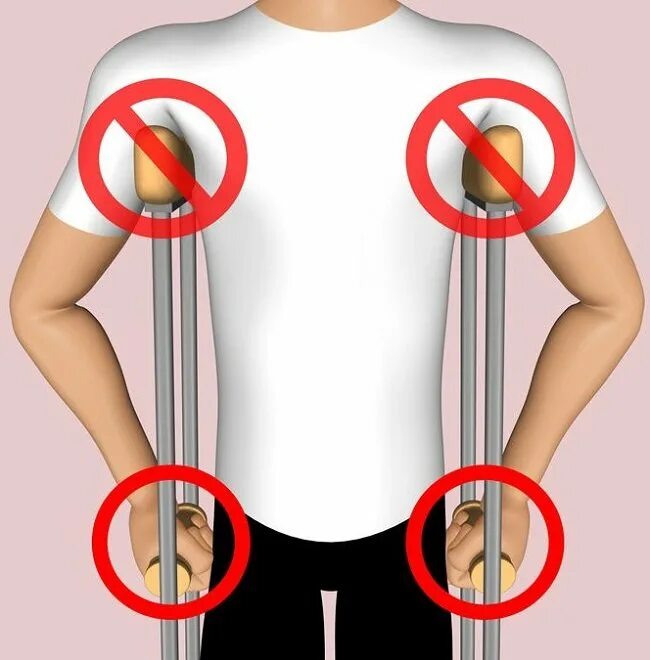 Как правильно подобрать костыли. Как правильно подобрать костыли по росту. Как правильно отрегулировать костыли подмышечные. Регулировка костылей подмышечных. Какмправильно подобрать костыли по росту.