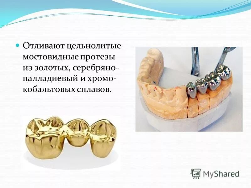 Лабораторные этапы металлокерамической коронки