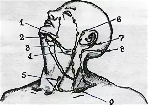 Лимфатический узел челюсть. Лимфоузлы на нижней челюсти расположение. Лимфоузлы на челюсти расположение схема. Лифмоузлынижеячелюсть. Лимфатические узлы на челюсти.