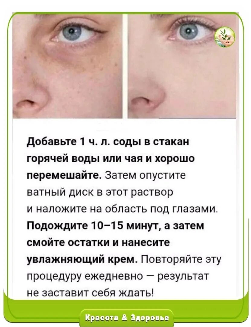 О чем говорят темные веки. О чем говорят темные веки. О чем говорят темные веки. О чем говорят темные веки. Тёмные круги под глазами причины.