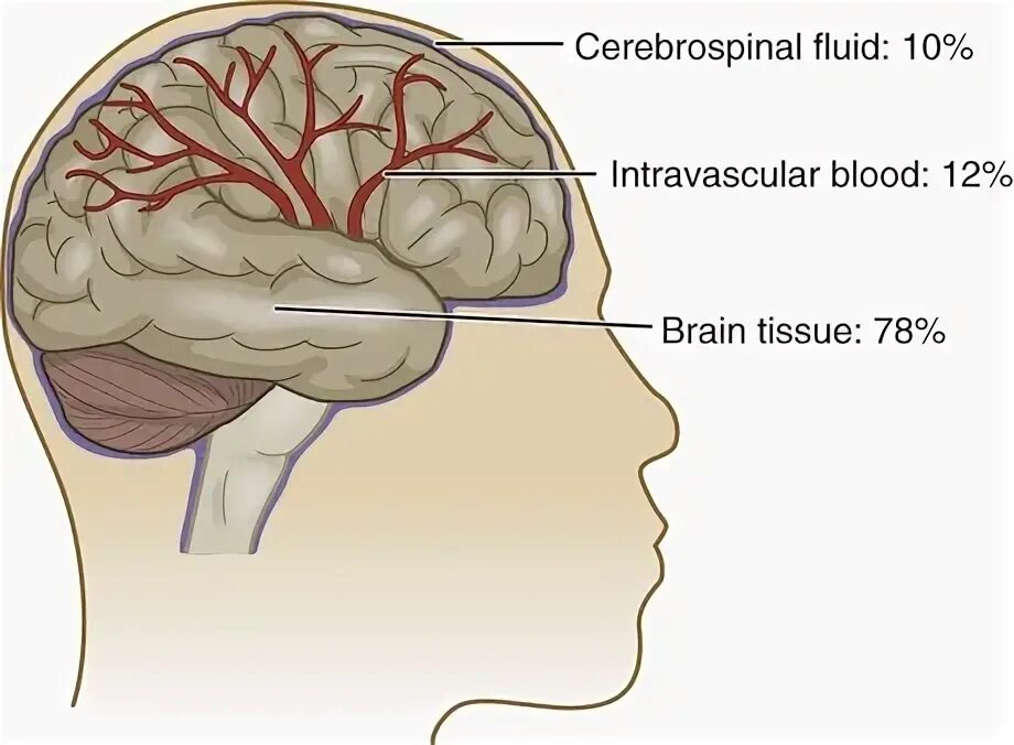 Brain 168. Increased intracranial Pressure. Intracranial Pressure Checker. Intracranial Pressure 3d.