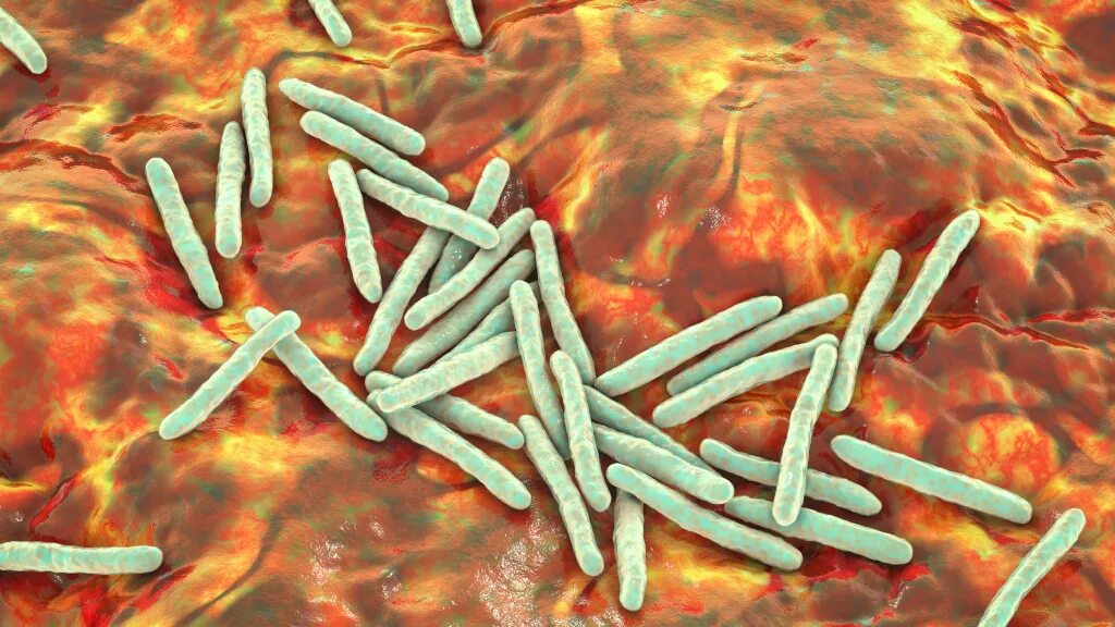 Mycobacterium tuberculosis complex