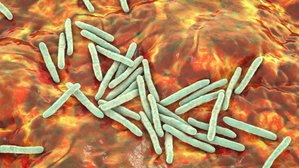 Штамм туберкулеза в великобритании. Микобактерия палочки Коха. Палочки – микобактерия туберкулеза. Палочка Коха возбудитель туберкулеза. Микобактерия туберкулеза палочка Коха.