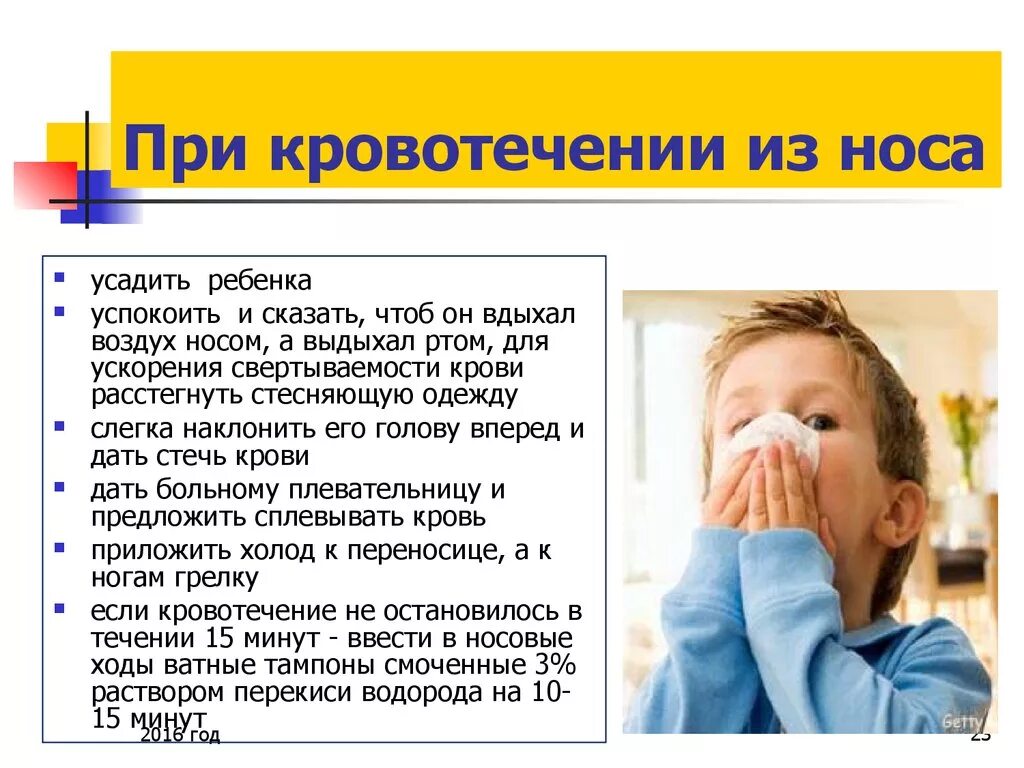 Если носовое кровотечение сопровождается. Причины кровотечения из носа у детей. Идёт кровь из носа причины. Кровь из носа у ребенка причины. Почему мдеь кровь из роса.