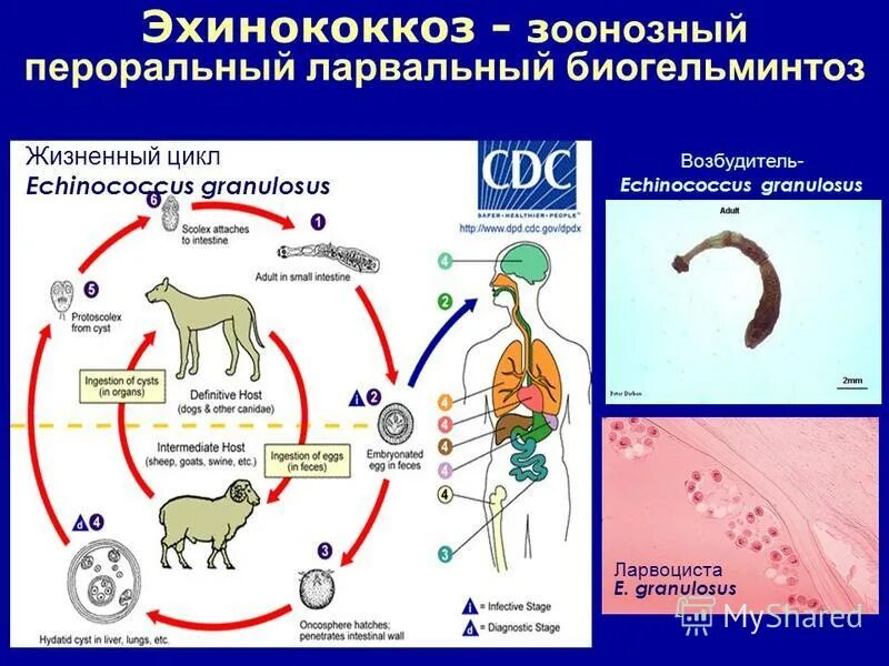 Эхинококкоз у детей симптомы. Цикл echinococcus granulosus. echinococcus granulosus окончательный хозяин. цикл развития эхинококка echinococcus granulosus. . цестодозы (эхинококкоз.