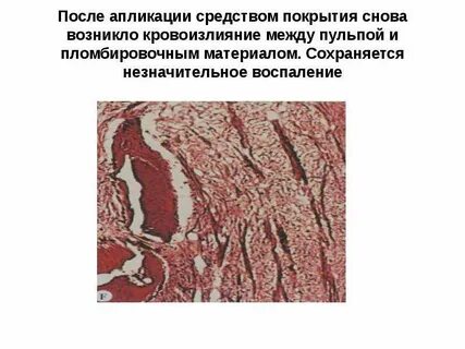 Для пульпы характерно