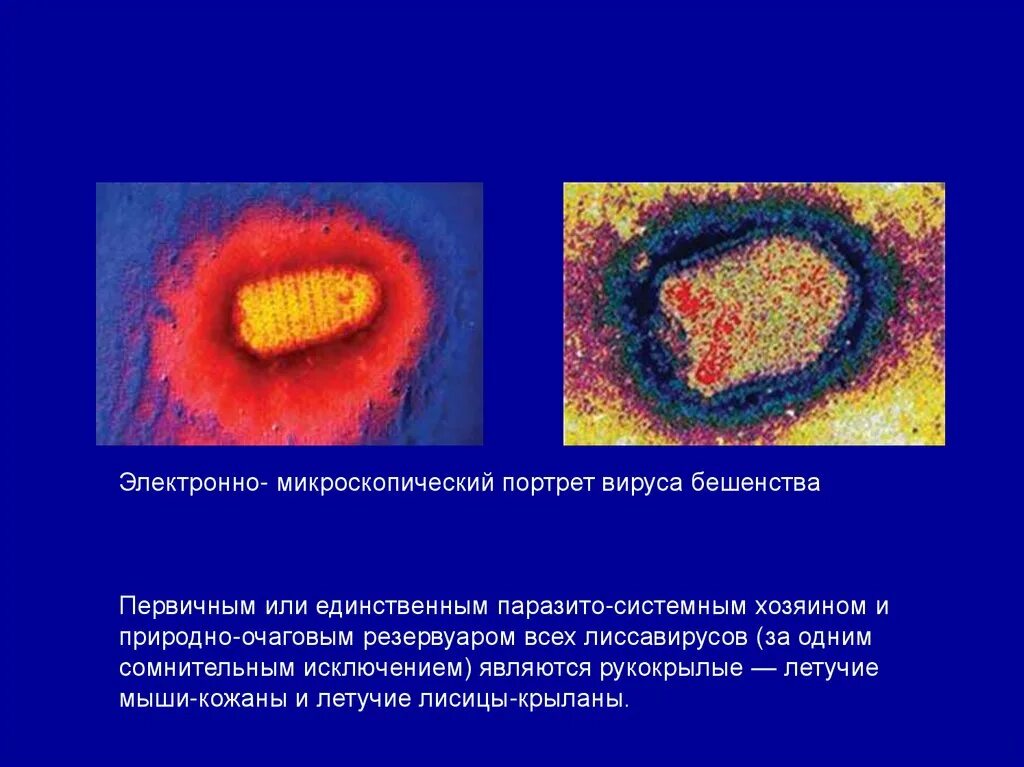 Бешенство этиология. Вирус бешенства 5 класс биология. Rabies virus возбудитель бешенства. Бешенство презентация. Вирус бешенства презентация.