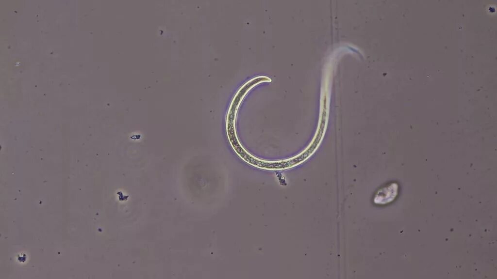 Черви в водорослях. Черви-паразиты нематоды.. Червь нематода Земляной. Паразиты белые червячки.