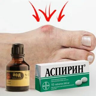 Какую мазь использовать при подагре