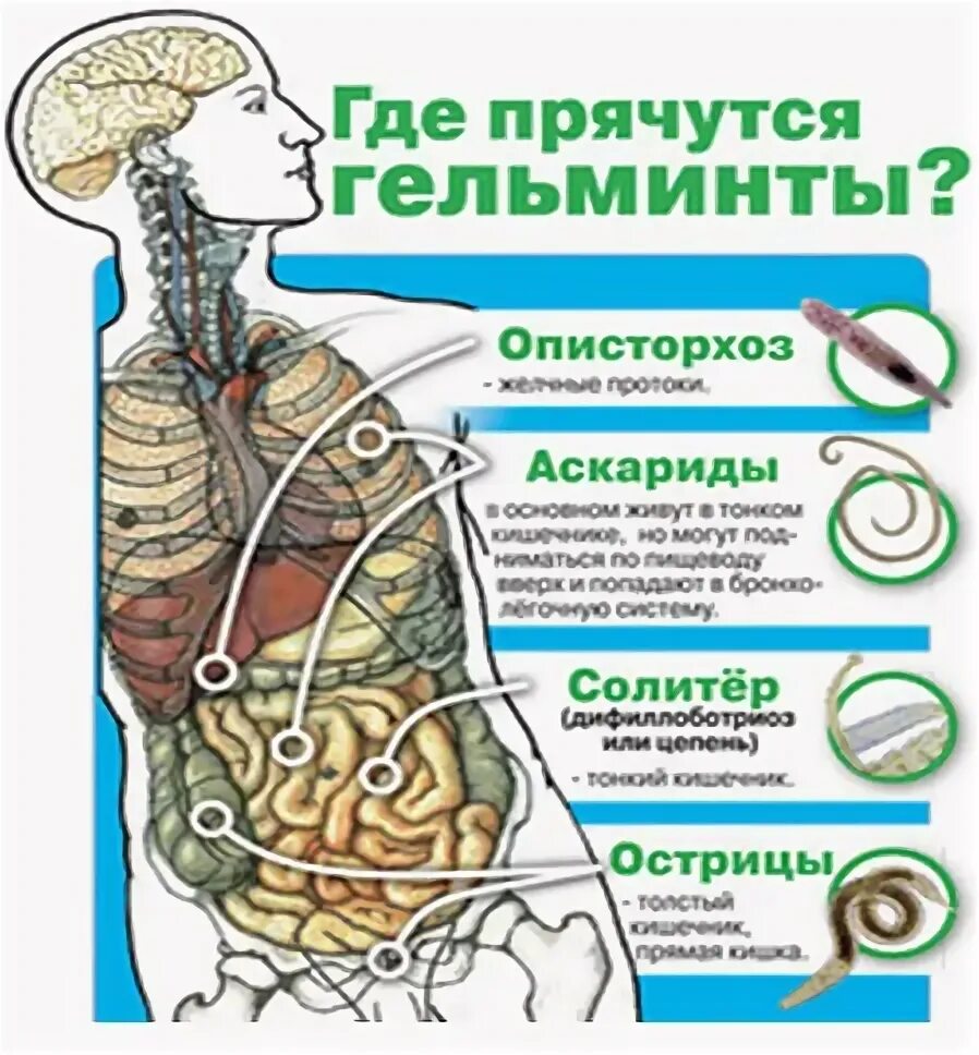 Кишечные гельминтозы - типичные симптомы паразитов, лечение глистной инвазии Med