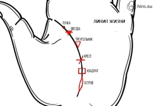 Линия жизни продолжительность жизни. Линия жизни раздваивается образуя треугольник. Линия жизни на руке. Треугольник на линии жизни. Ответвление от линии жизни.