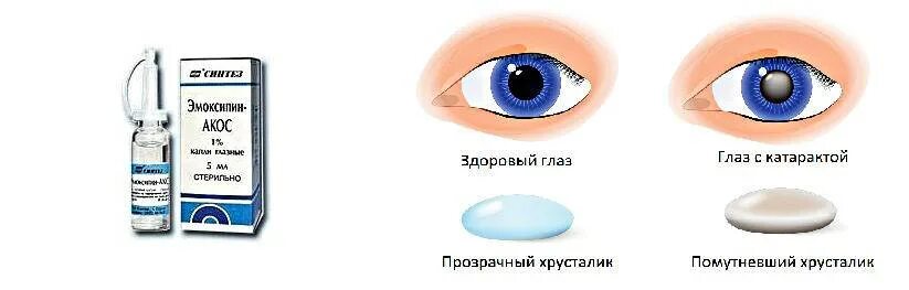 Эффективные капли при катаракте глаза. Катаракта капли глазные. Глазные капли катаракта глаукома. Катаракта глаза глазные капл. Глазная катаракта капли от катаракты.