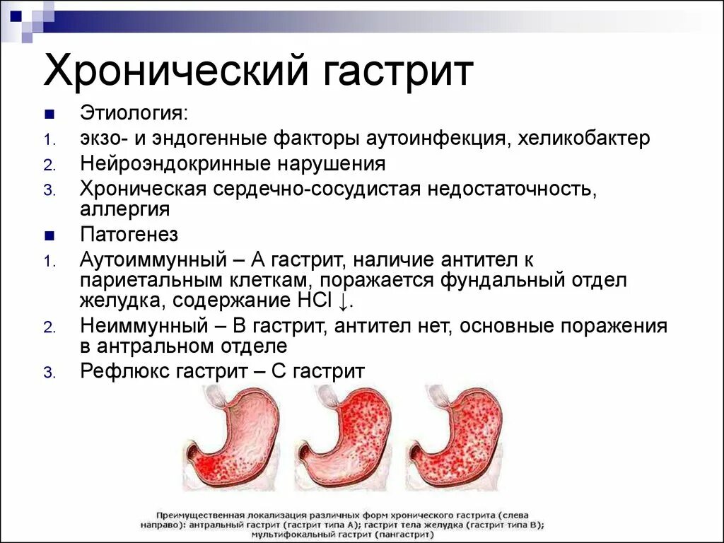 Сколько лечится гастрит у взрослых. Патогенез хронического гастрита хеликобактер пилори. антральный гастрит синдромы. хронический антральный гастрит. фундальный гастрит симптомы.