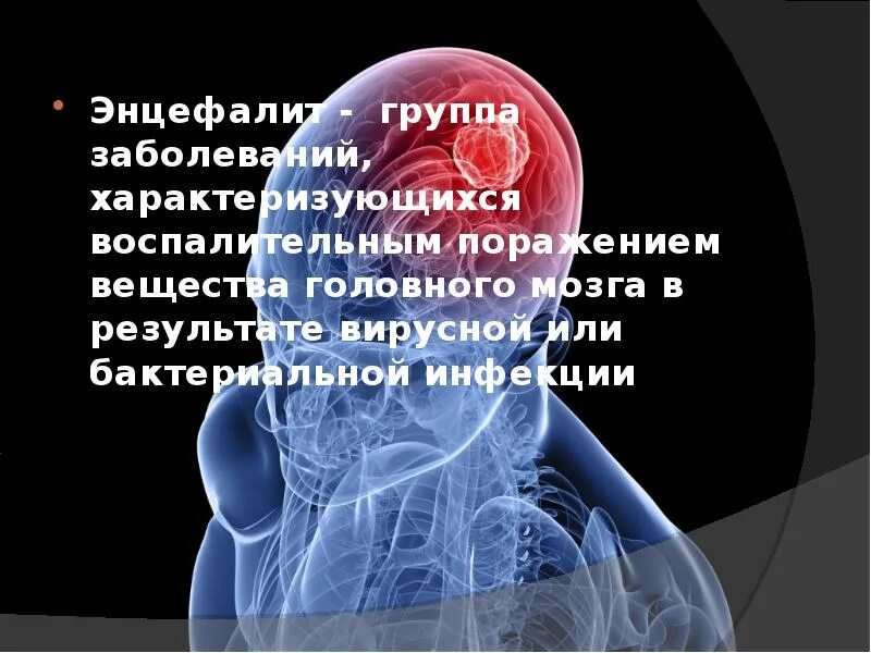 Воспалительные заболевания головного мозга. Восполениеголовного мозга. Воспаление головного мозга латынь