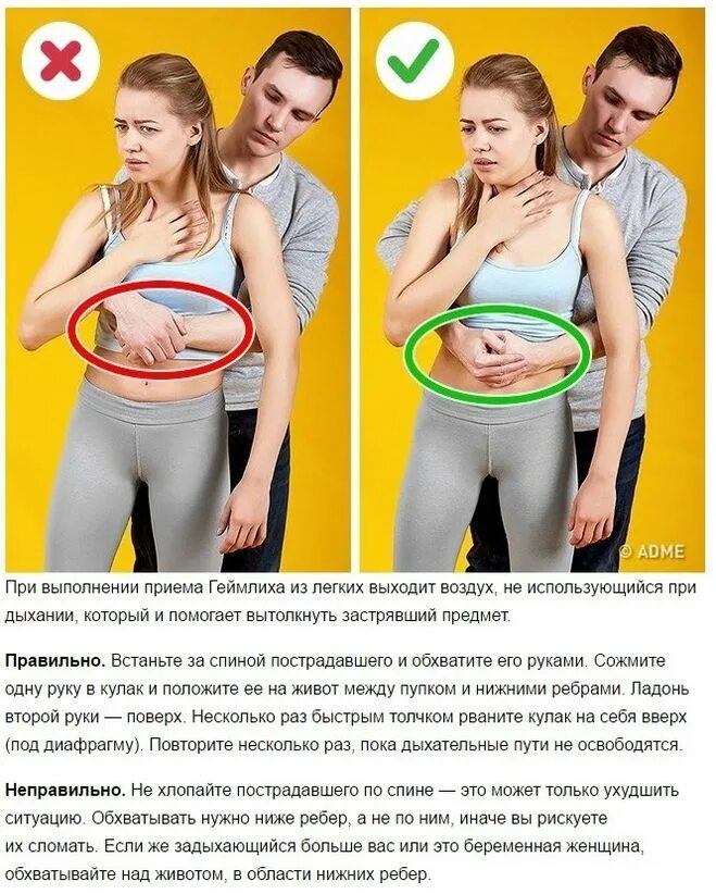 Что делать если человек подавился первая помощь. Как помочь задыхающемуся человеку. Как помочь задыхающемуся человеку. Приём хеймлиха у детей. Человек подавился прием геймлиха.