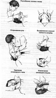 Выдвижение вперед