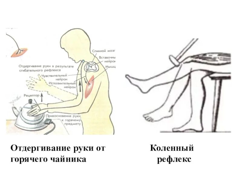 Рефлекторная дуга при отдергивание руки от горячего предмета. Отдергивание руки от горячего предмета. Рефлекторная дуга анатомия человека. Коленный рефлекса отдергивания руки. Начертите схему рефлекторной дуги отдергивания руки.
