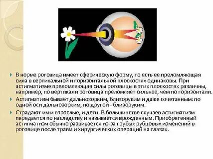 Преломляющая сила глаза