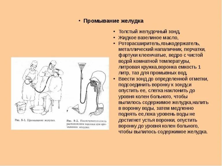Установите правильную последовательность при промывании желудка. Методика зондового промывания желудка. методика выполнения промывания желудка алгоритм. промывания желудка зондом алгоритм выполнения. схема алгоритм промывание желудка.