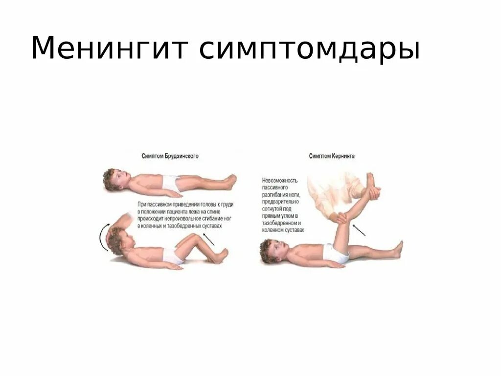 Симптомы менингита у человека. Менингеальные симптомы у детей 3 лет. Менингококковый менингит симптомы Брудзинского. Менингеальные симптомы у детей 7 лет. Менингит симптомы у детей 6 7 лет.