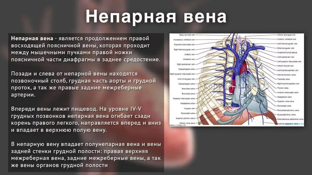 Верхняя полая Вена непарная Вена. Верхняя полая Вена притоки. Верхняя полая Вена топография притоки. Вены анатомия верхняя полая Вена.