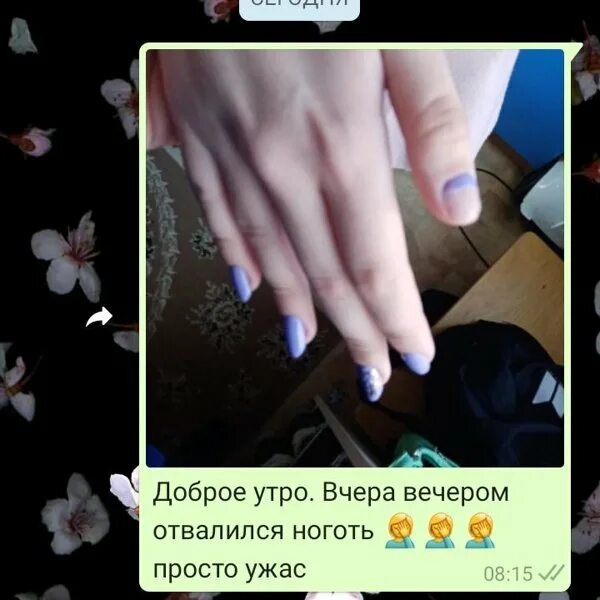 Почему наращивание ногтей отваливается