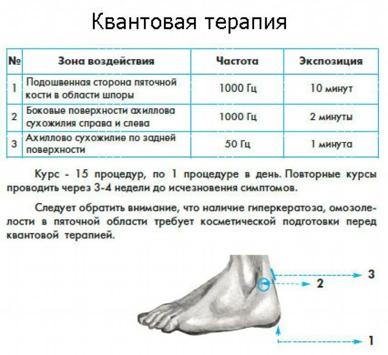 Схема лечения витафоном при пяточной шпоре. Схема лечения пяточной шпоры витафоном. Витафон пяточная шпора схема. Схема установки витафона при пяточной шпоре. Диагноз болей в стопе