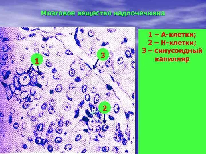 Хромаффинные клетки надпочечников гистология. Хромаффинные клетки мозгового вещества надпочечников. Хромаффинные клетки мозгового слоя надпочечников. Хромаффинная ткань гистология. Хромаффинные клетки надпочечников гистология.