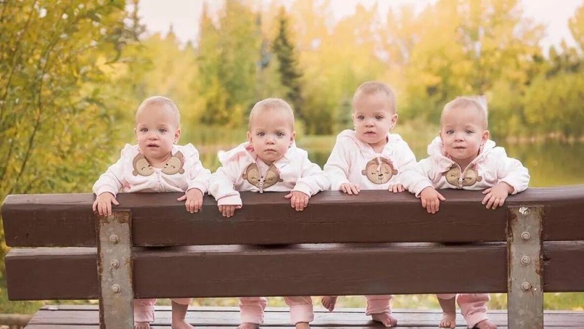 Четверо близнецов. Четыре близняшек. Quadruplets. Genain quadruplets.