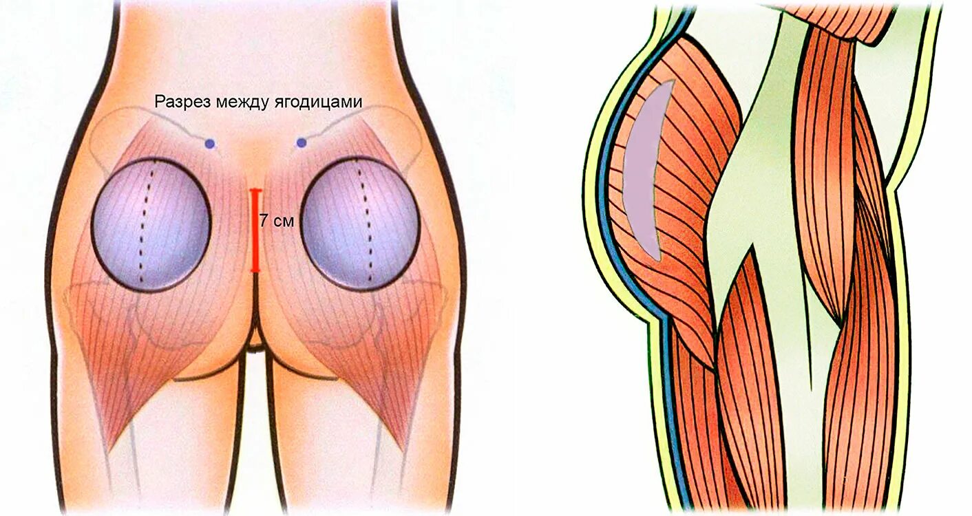 ямочки венеры девушка. крепкие ягодицы. стройные ноги и ягодицы. женская спина. строение ягодиц.