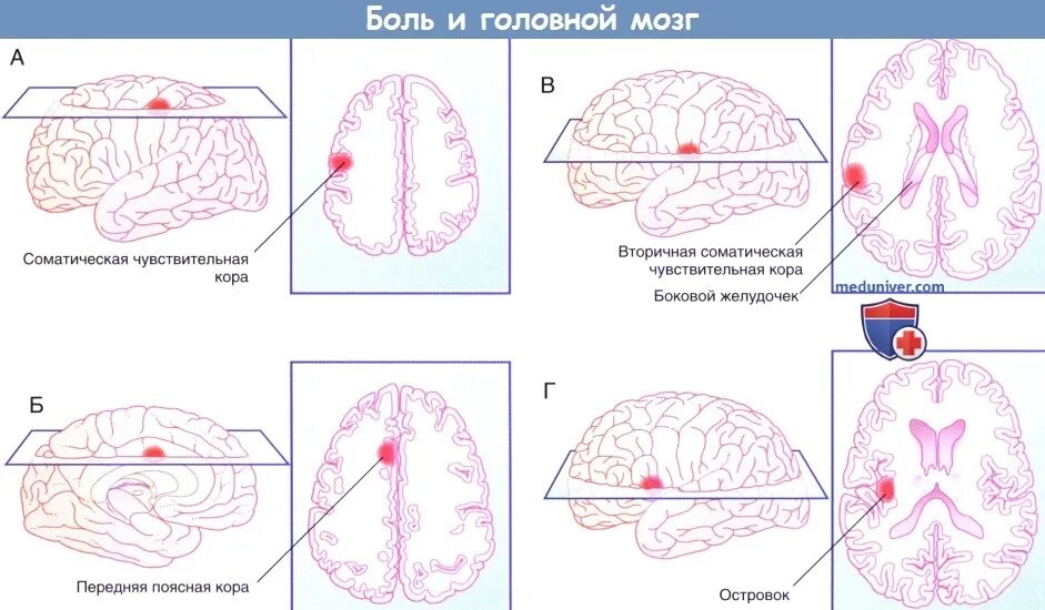 Болевой центр в мозге. Боль в коре головного мозга. Передняя поясная извилина коры головного мозга.