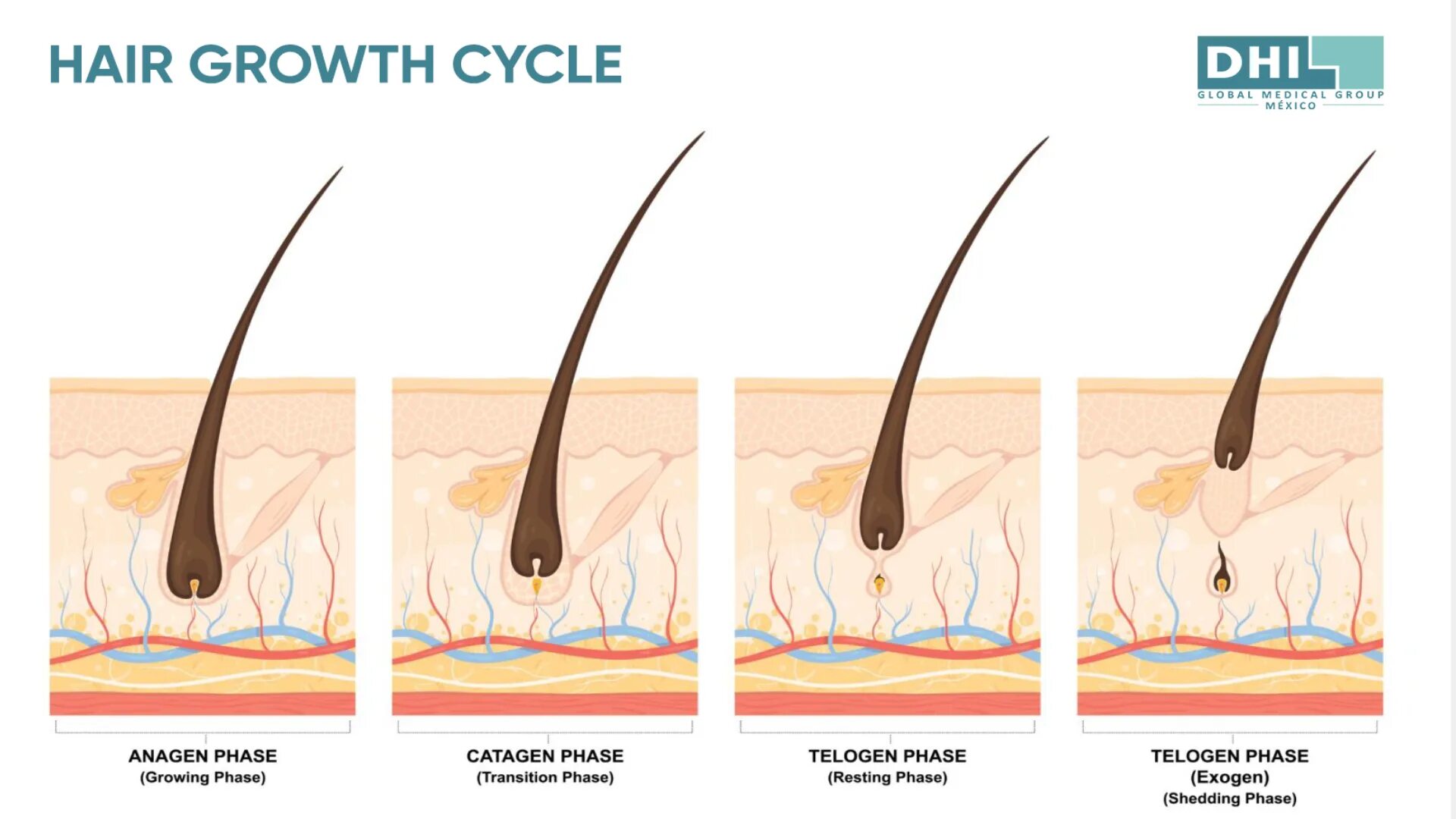 Растут корни волос. Жизненный цикл волоса анаген. Ресницы анаген катаген. Анаген катаген телоген. Фазы роста волос анаген.